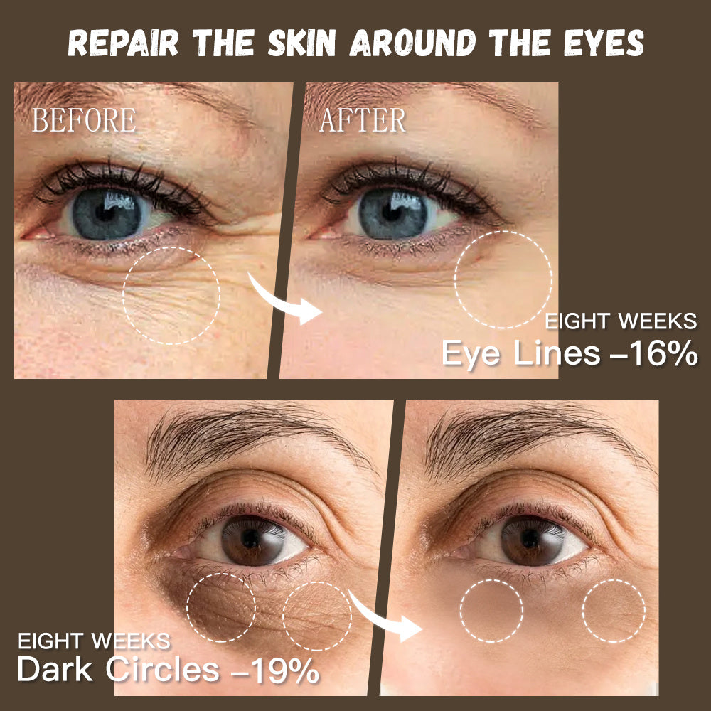 Natural Skincare Retinol Eye Cream Vegan Organic Anti Aging Moisturizer Anti-wrinkle Skin Whitening Retinol Eye Cream